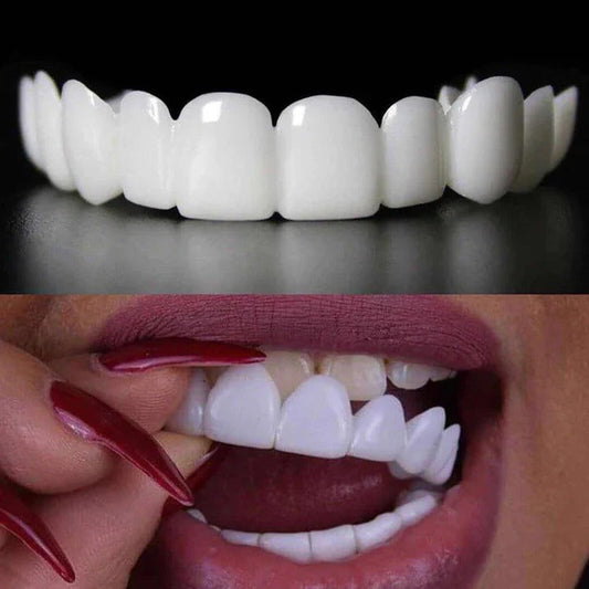2Pcs/Set Comfort Fit White Teeth Cover Veneer Kit