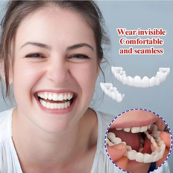 2Pcs/Set Comfort Fit White Teeth Cover Veneer Kit